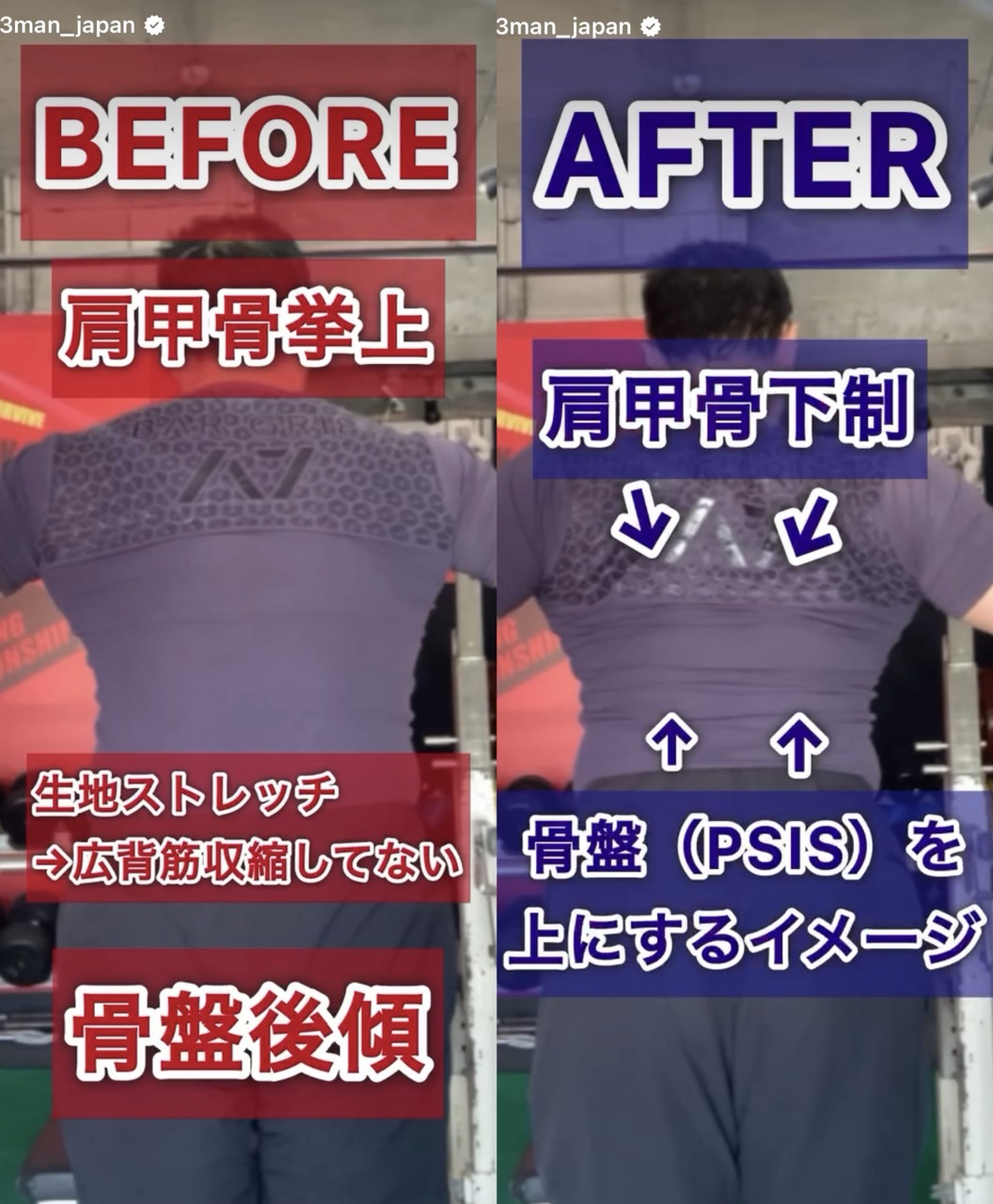 広背筋のBEFOREとAFTER比較。肩甲骨挙上と骨盤後傾、下制と骨盤安定の違い