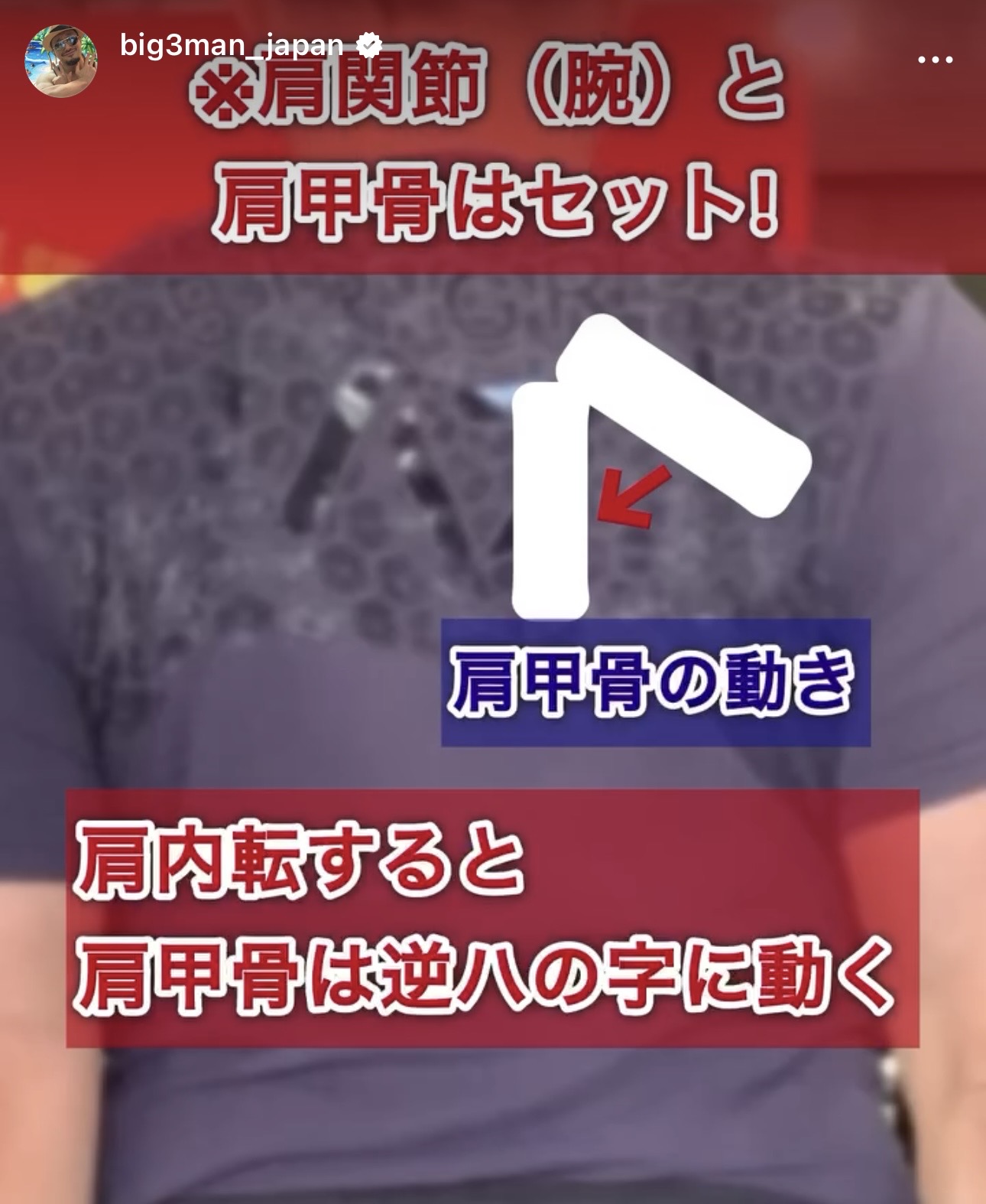 肩関節内転に伴い肩甲骨が逆ハの字方向へ動く様子